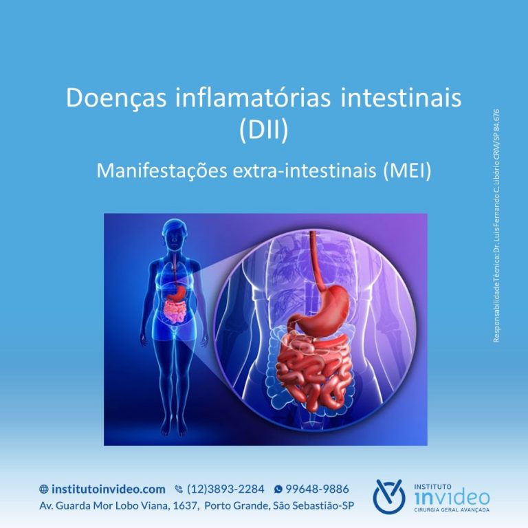 Doenças Inflamatórias Intestinaisdii Manifestações Extra Intestinaismei Instituto Invideo 